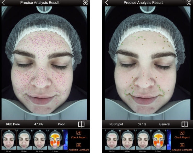 Zemits VeraFace 肌分析システム