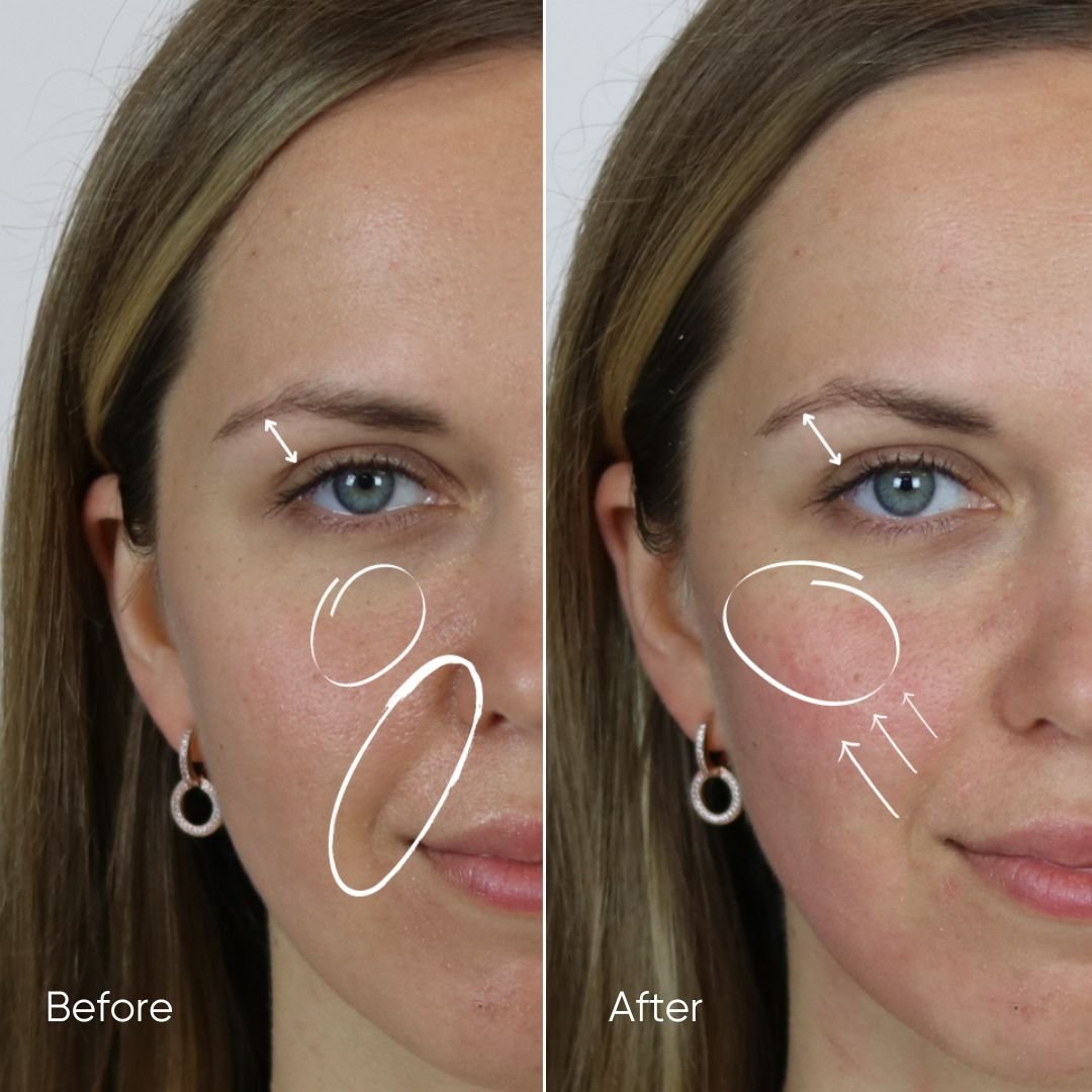 Zemits HydroVerstand PRO 7-in-1 ハイドロダイヤモンド™システム